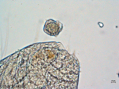 phyto/Thau_Lagoon/THAU_station1/GELAMED 2010/Nematodinium sp (2)(copy)_thumb.jpg